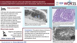 A challenging case of lupus-like immune-complex mediated glomerulonephritis associated with sinusoidal obstructive syndrome