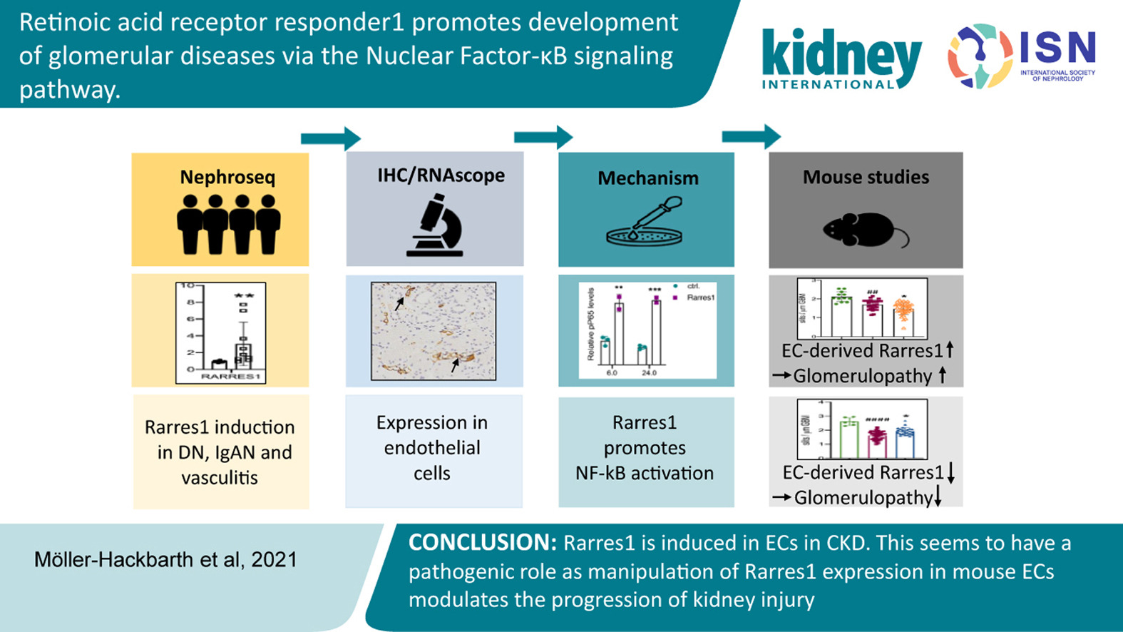 Retinoic Acid Receptor Responder1 Promotes Development of Glomerular Diseases via the Nuclear Factor-KB Signaling Pathway