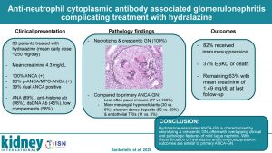 ANCA-associated Glomerulonephritis Complicating Treatment with Hydralazine